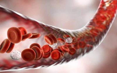 Расстройство кровообращения (Часть 2)